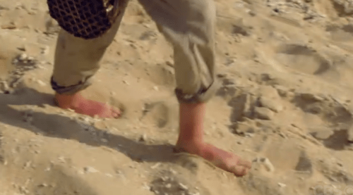 Cochrane Sunburnt Feet